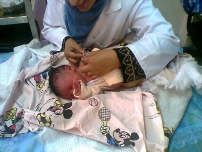 تطعيم حديثي الولادة 