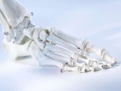 إنماء مفاصل اصطناعية خاصة لكل مريض باستخدام طابعة ثلاثية الأبعاد