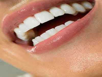 تبييض الأسنان يمكن ان يسبب مخاطر صحية خطيرة للعيون والجلد