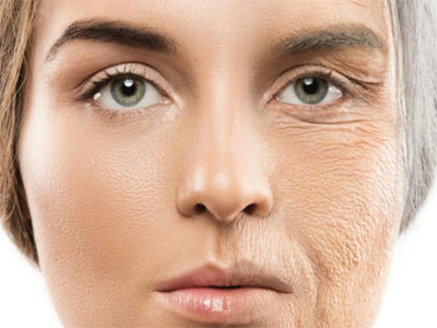 بخطوات بسيطة يمكن إبطاء عملية الشيخوخة التي تصيب الجلد بالترهل