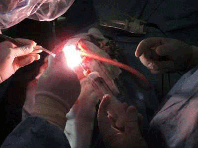عملية جراحية ناجحة بمستشفى الهواري  