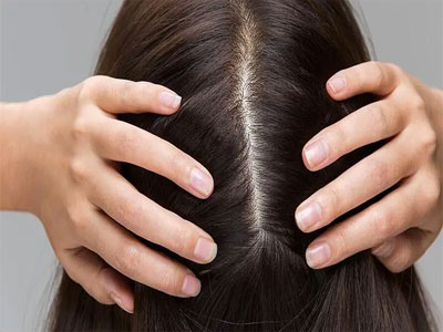 جفاف الجلد والتهاب الجلد الدهني والحساسية لمنتجات الشعر أهم أسباب قشرة الرأس