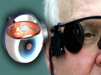 “العين الإلكترونية”: فرصة جديدة للمصابين بالعمى 