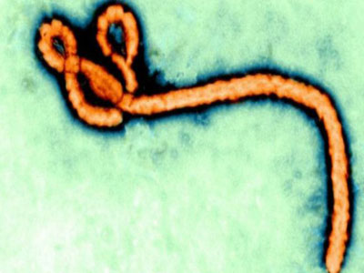 مسكن الألم آيبوبروفين قد يبطل مفعول فيروس إيبولا