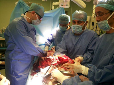 عملية إستئصال لورم سرطاني بمستشفى مصراته