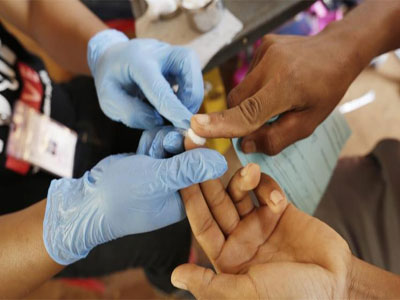 قرب التوصل إلى علاج نهائي لمرض نقص المناعة المكتسبة