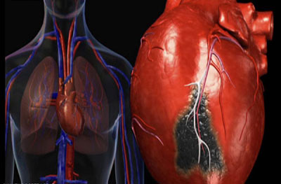 صحة قلبك مرتبطة بمهنتك