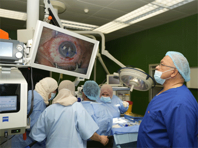 اجراء 80 عملية للقرنية بمستشفى العيون طرابلس